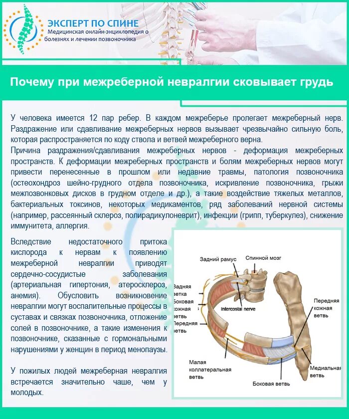Невралгия меж рёберная симптомы. Схема лечения межреберной невралгии грудного отдела. Межркберная неврология. Межребренеая неврология. Чем снять межреберную невралгию