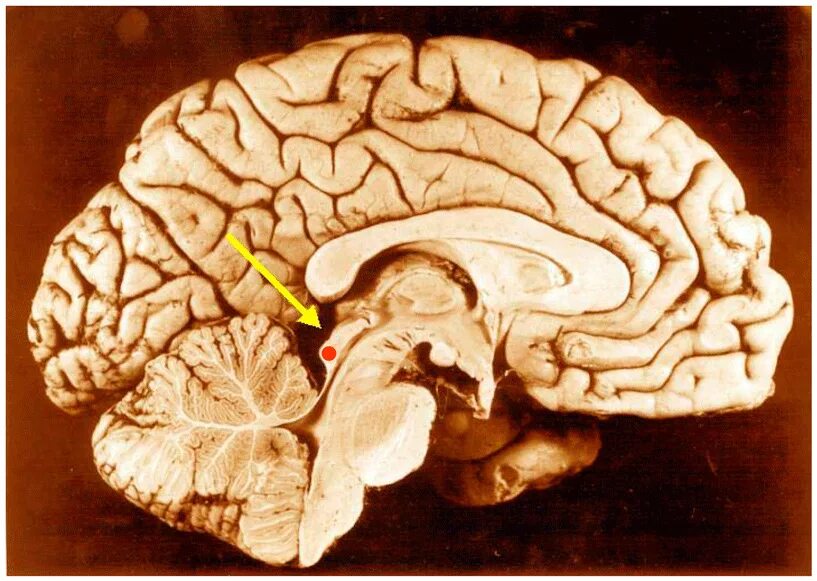 Верхние холмики мозга. Срединный Сагиттальный срез головного мозга. Сагиттальный срез среднего мозга. Сагиттальный срез мозга на препарате. Сагиттальный разрез головного мозга препарат.