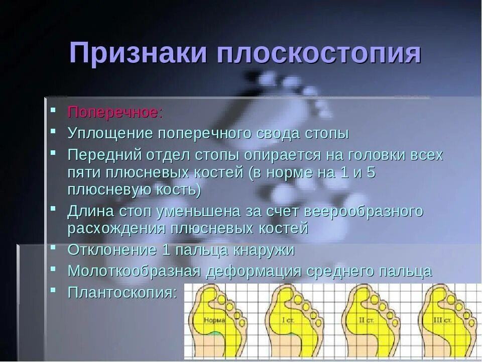 Чем может быть вызвано плоскостопие у человека. Признаки плоскостопия. Первые симптомы плоскостопия. Поперечное плоскостопие симптомы. Причины и симптомы плоскостопия.