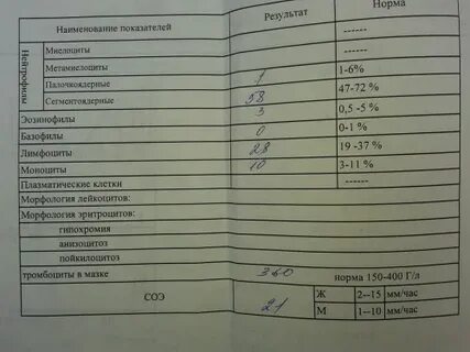 В анализе мочи обнаружены лейкоциты
