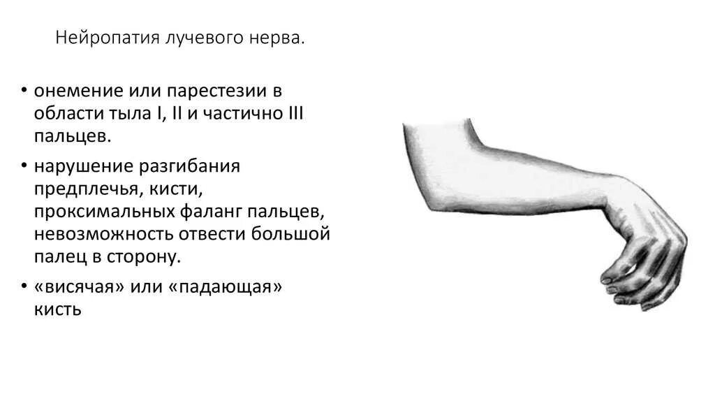 Невропатия конечностей симптомы. Кисть при нейропатии лучевого нерва. Нейропатия локтевого и лучевого нерва. Клинические проявления нейропатии лучевого нерва. Лучевой и локтевой нерв. Симптомы поражения.