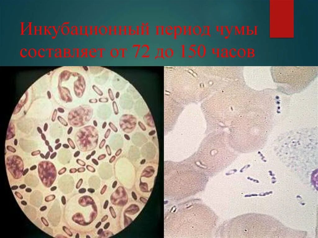 Заболевание чума вызывает. Чума инкубационный период. чума источник возбудителя инфекции.
