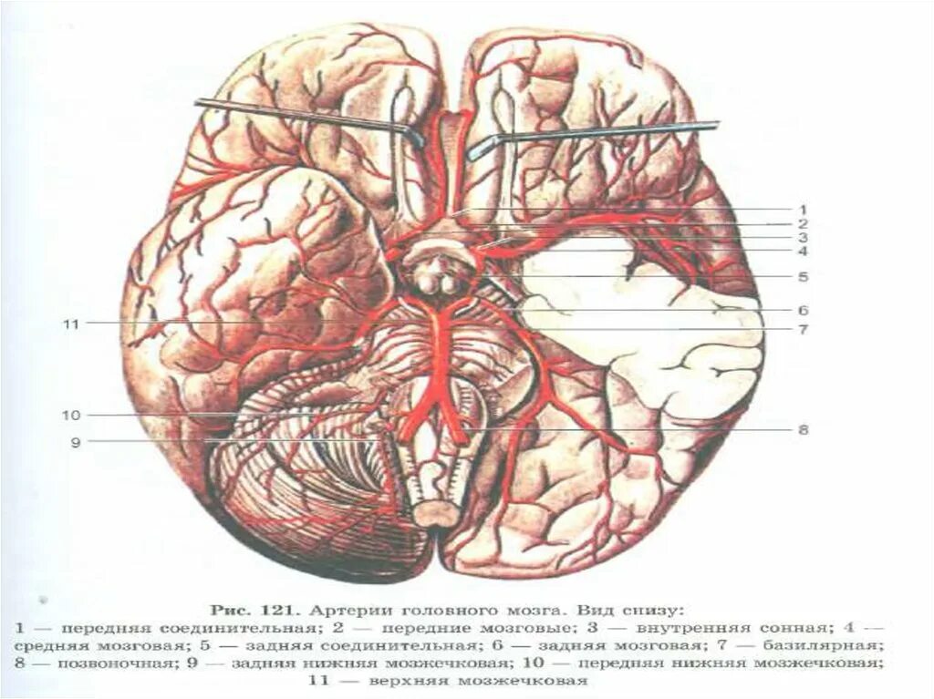 Соединительные артерии головного мозга. Передняя соединительная артерия головного мозга анатомия. Задняя соединительная артерия головного мозга. Ветви средней мозговой артерии анатомия. Мозговые артерии латынь