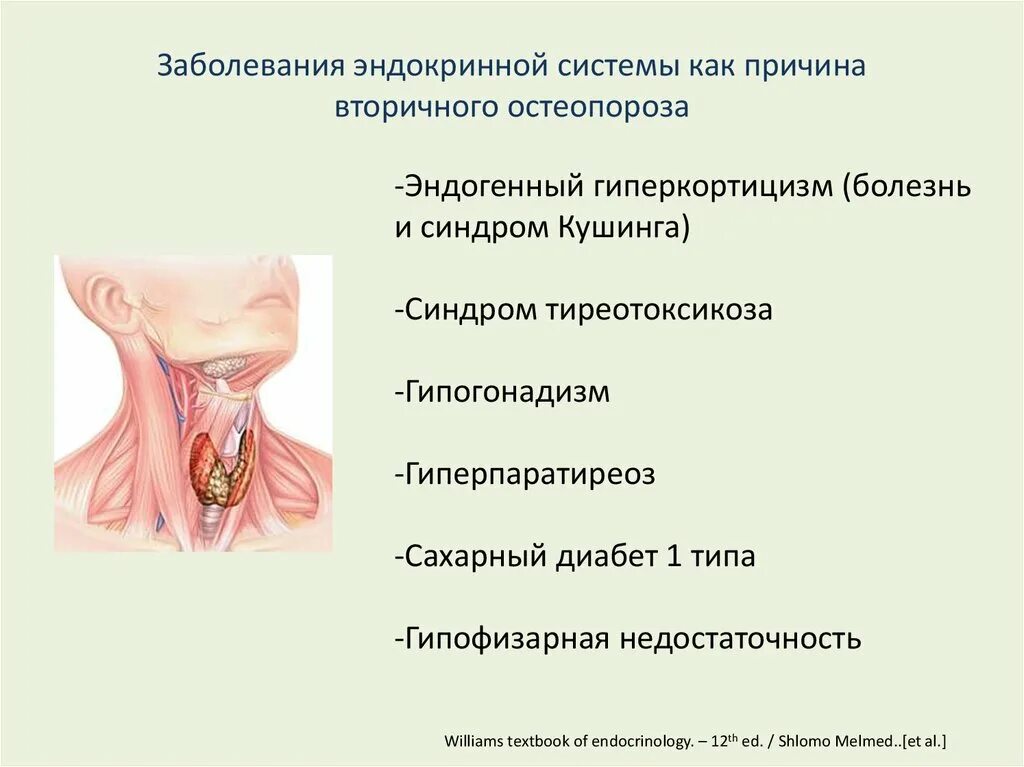 Заболевания эндокринной системы. Основные эндокринные заболевания. Заболевания эндокринной системы симптомы. Заболевания Эндокриная системы.