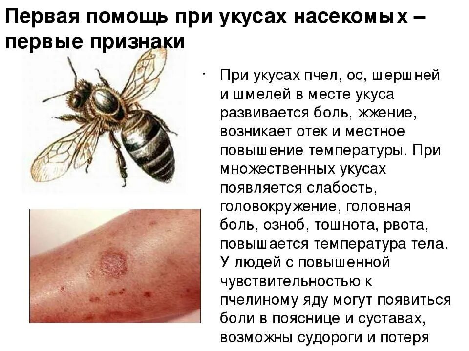 Укусы ос помощь в домашних условиях. Симптомы при укусе пчелы.