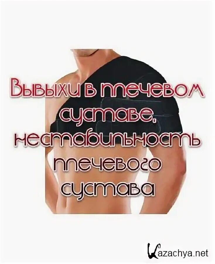 Нестабильность плечевого сустава мкб. Нестабильность плечевого сустава мкб
