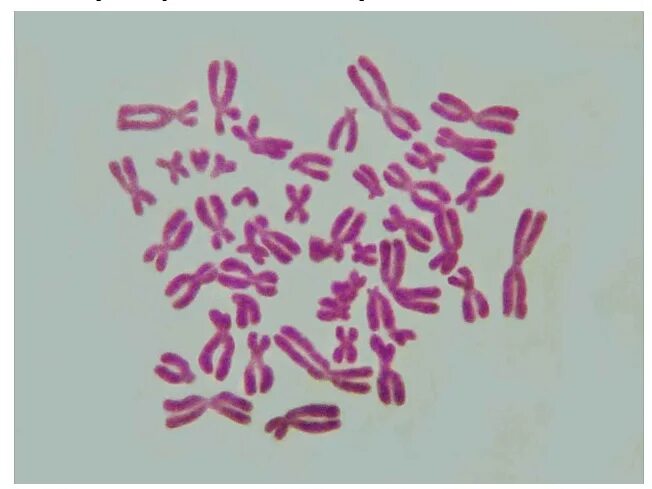 Файл:Human karyotype (248 27) Human karyotype.jpg - Вікіпедія