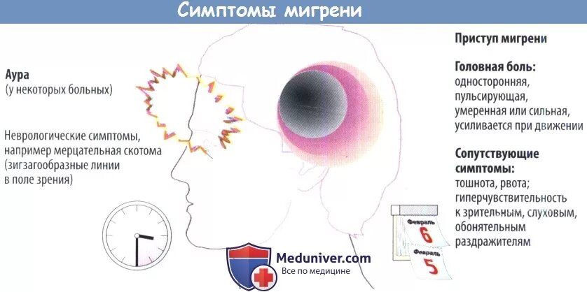 Глазная мигрень Мерцательная скотома. Зрительная скотома мерцающий. Зрительная мигрень симптомы. Глазная мигрень симптомы.