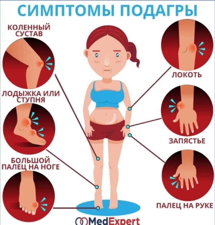 Подагра причины возникновения