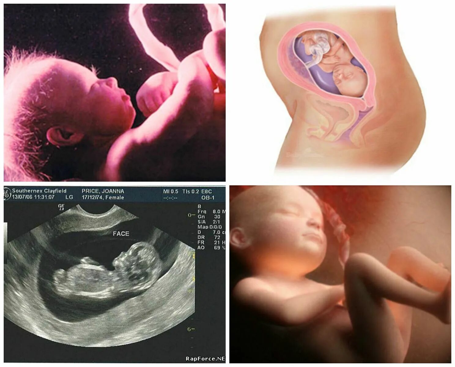 26 недель что происходит с малышом. 27 Неделя беременности фото плода. Ребенок на 26 неделе беременности УЗИ. 26 Неделя беременности фото плода. Беременность 26-27 недель фото плода.