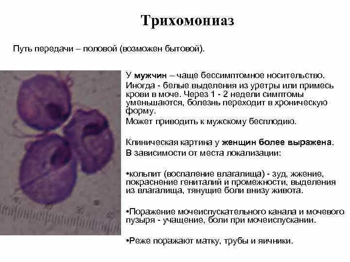 Трихомонада у мужчин симптомы