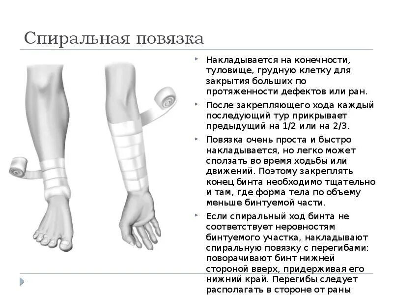 Спиральная повязка техника наложения. Методика наложения спиралевидной повязки.. Спиральная повязка(для защиты больших РАН И дефектов. Спиральная повязка с перегибами алгоритм.
