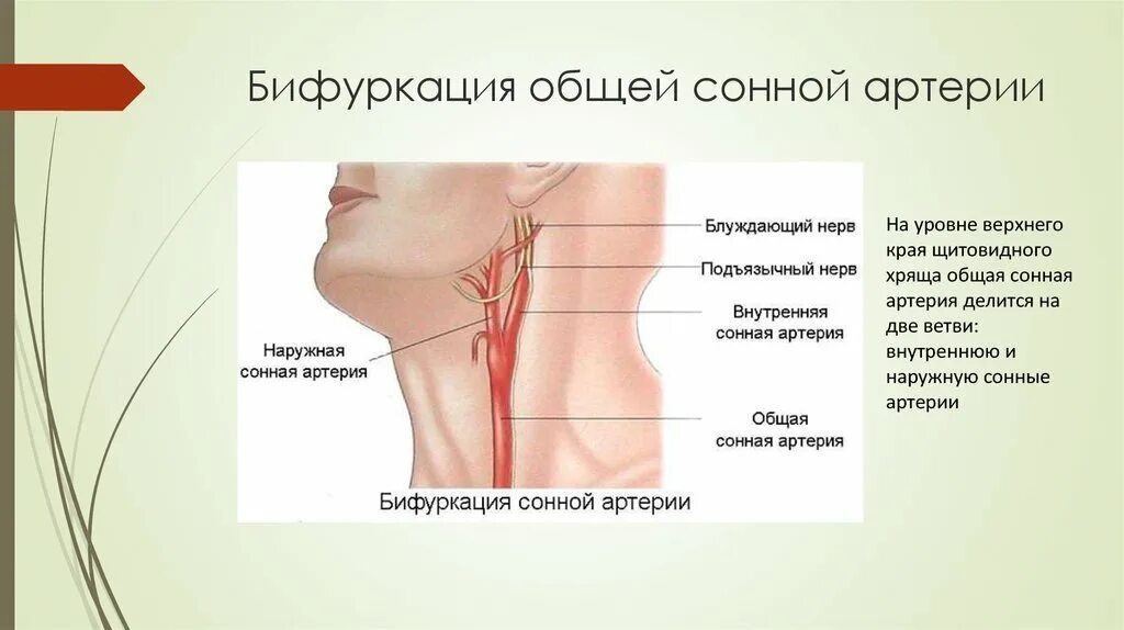 Бифуркация общей сонной на уровне. Уровень бифуркации общей сонной артерии. Бифуркация сонной артерии. Бефуркуры сонной артерии. Общая сонная артерия находится