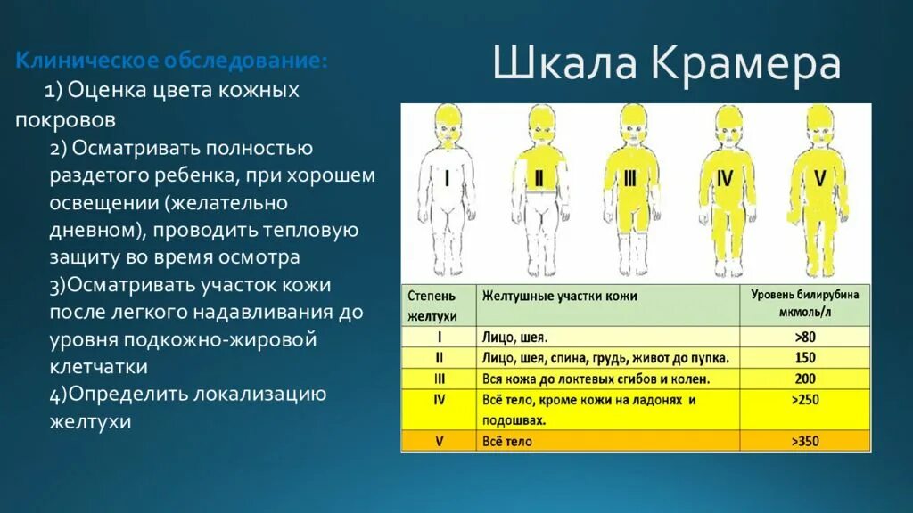 Билирубин при желтухе у новорожденных. Желтушка у новорожденных шкала. Желтуха новорожденных шкала Крамера. Оценка желтухи по шкале Крамера. Шкала оценки желтухи новорожденных.