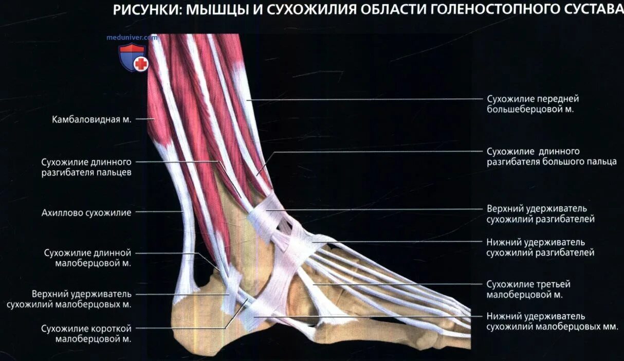 Как называется воспаление сухожилий