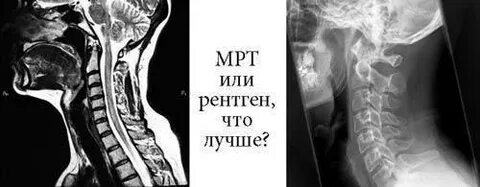 В чем разница кт и мрт позвоночника