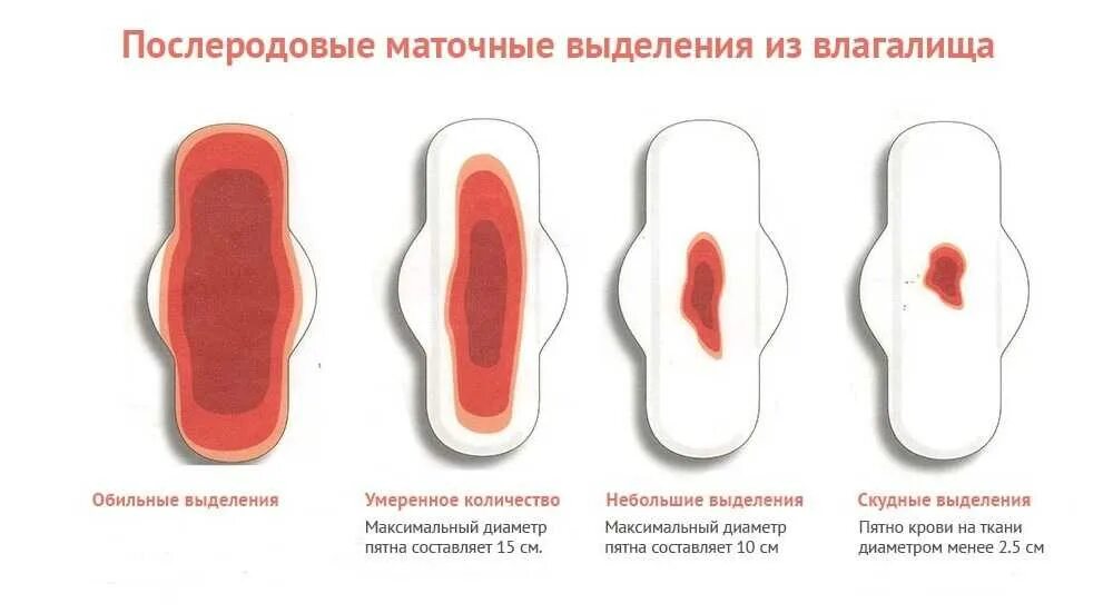 Как выглядит матка во время месячных