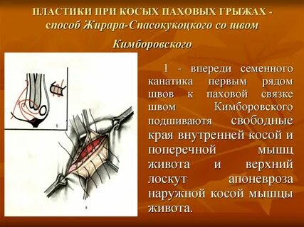 Грыжа под операция отзывы