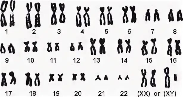 Кариотип собаки состоит из 78