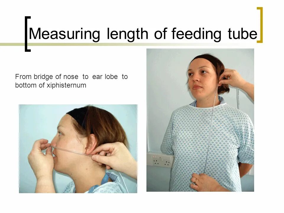 Измерение зонда. Измерение желудочного зонда. Измерение зонда для промывания желудка. Измерение длины зонда для промывания желудка.