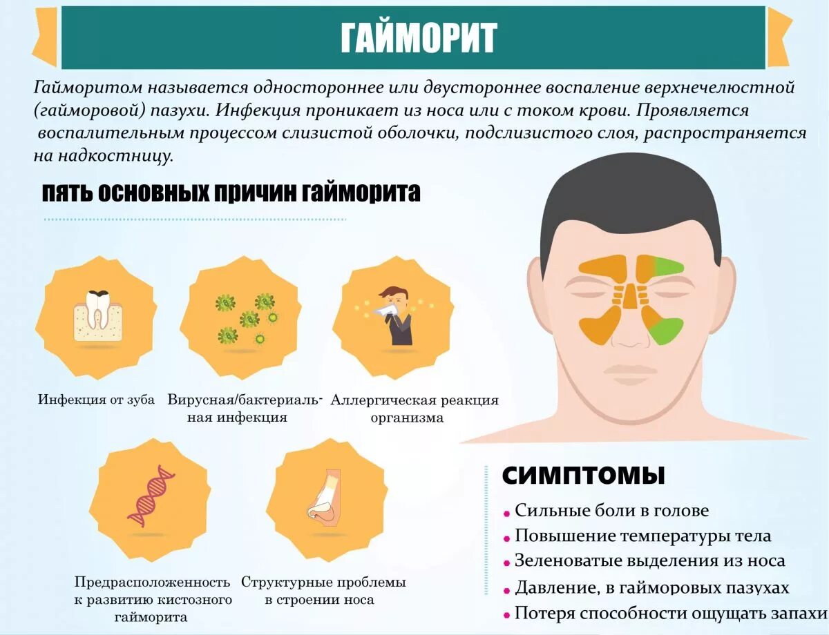 Носовые пазухи гайморит. Сколько лечат гайморит