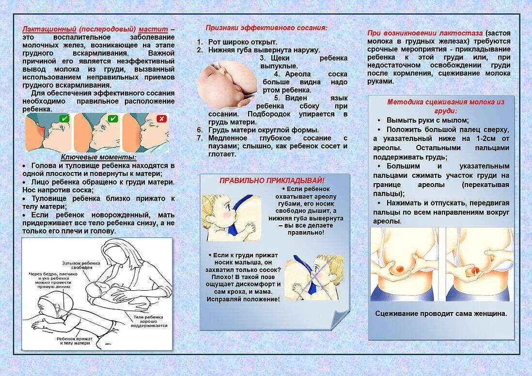Как правильно подготовить молочные железы к кормлению. Лактационный мастит профилактика. Как разминать грудь для кормления. Массааж Руди при грудном вскармливпнии. Лактостазы у кормящей мамы