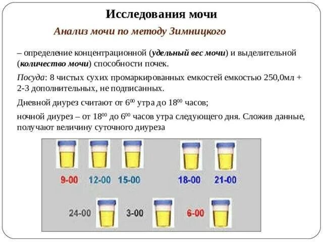 Можно мочу на анализ собрать вечером. - Анализ мочи по Нечипоренко; - анализ мочи по Зимницкому. Исследование мочи по Нечипоренко и Зимницкому. Алгоритм проведения исследования мочи по Зимницкому. Анализ мочи по Нечипоренко и Зимницкому.