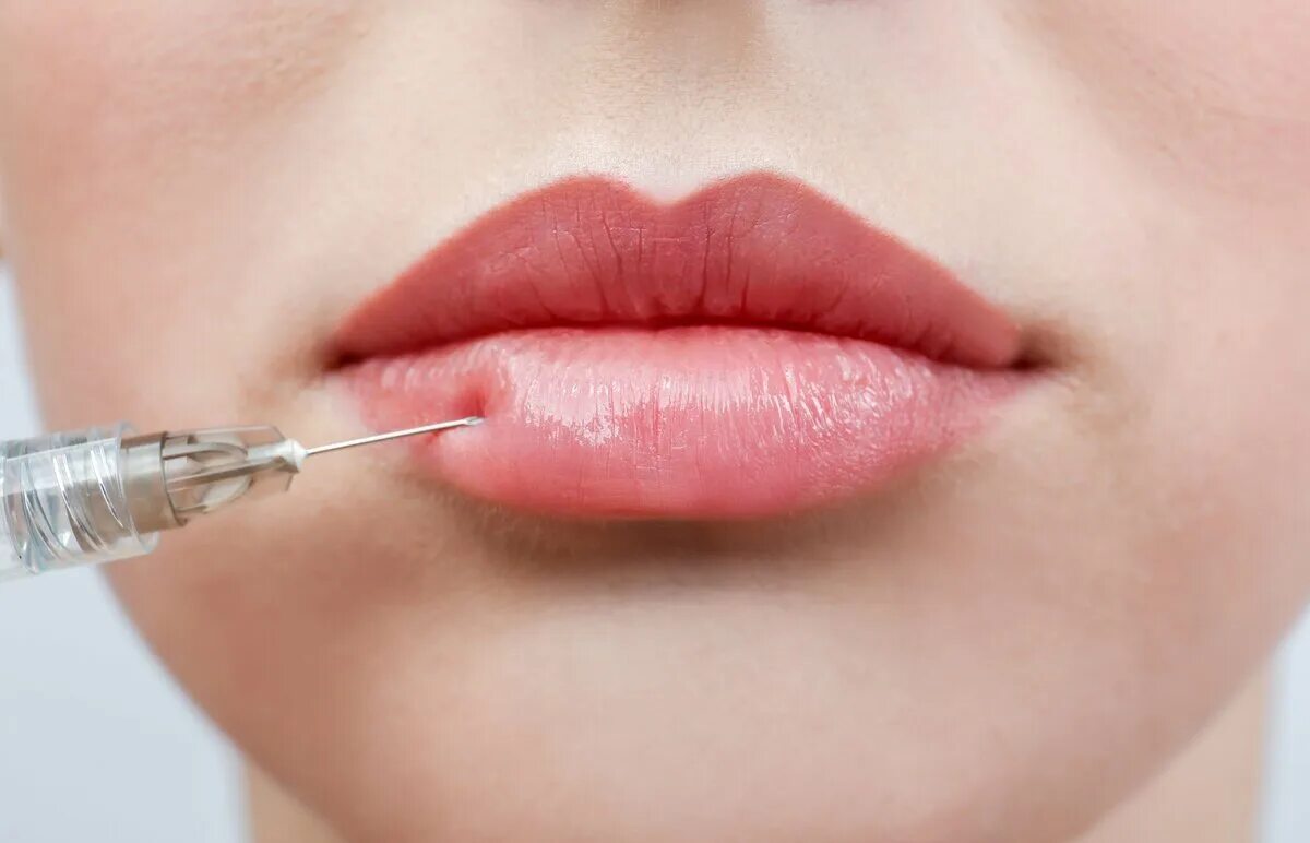 Красивое увеличение губ skin expert. Красивая форма губ. идеальная форма губ. косметология губы.