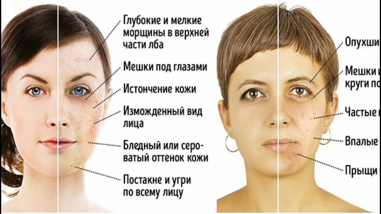 Как выглядит сахарное лицо Вы не поверите, но эти 5 продуктов ускоряют процесс старения! Женские хитрости Д