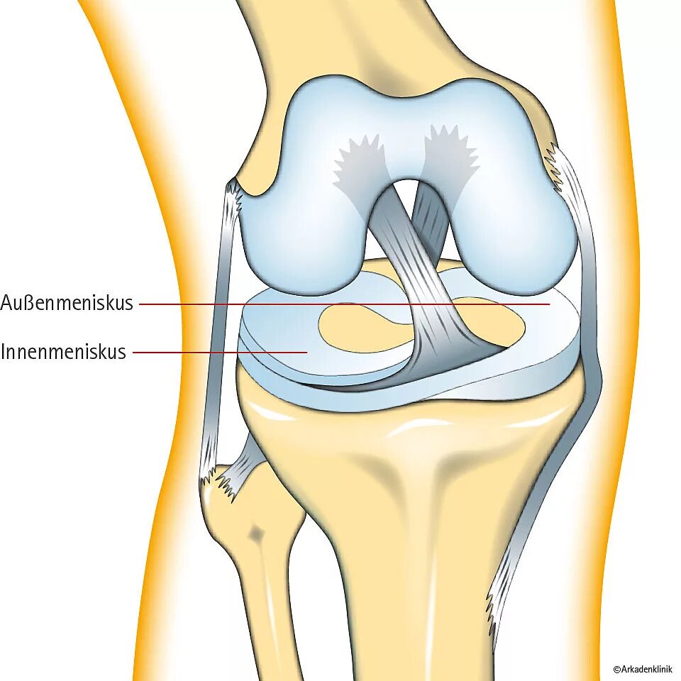 Мениск коленного сустава. Мениски коленного сустава анатомия. Суставные мениски коленного сустава. Поврежденный мениск коленного сустава