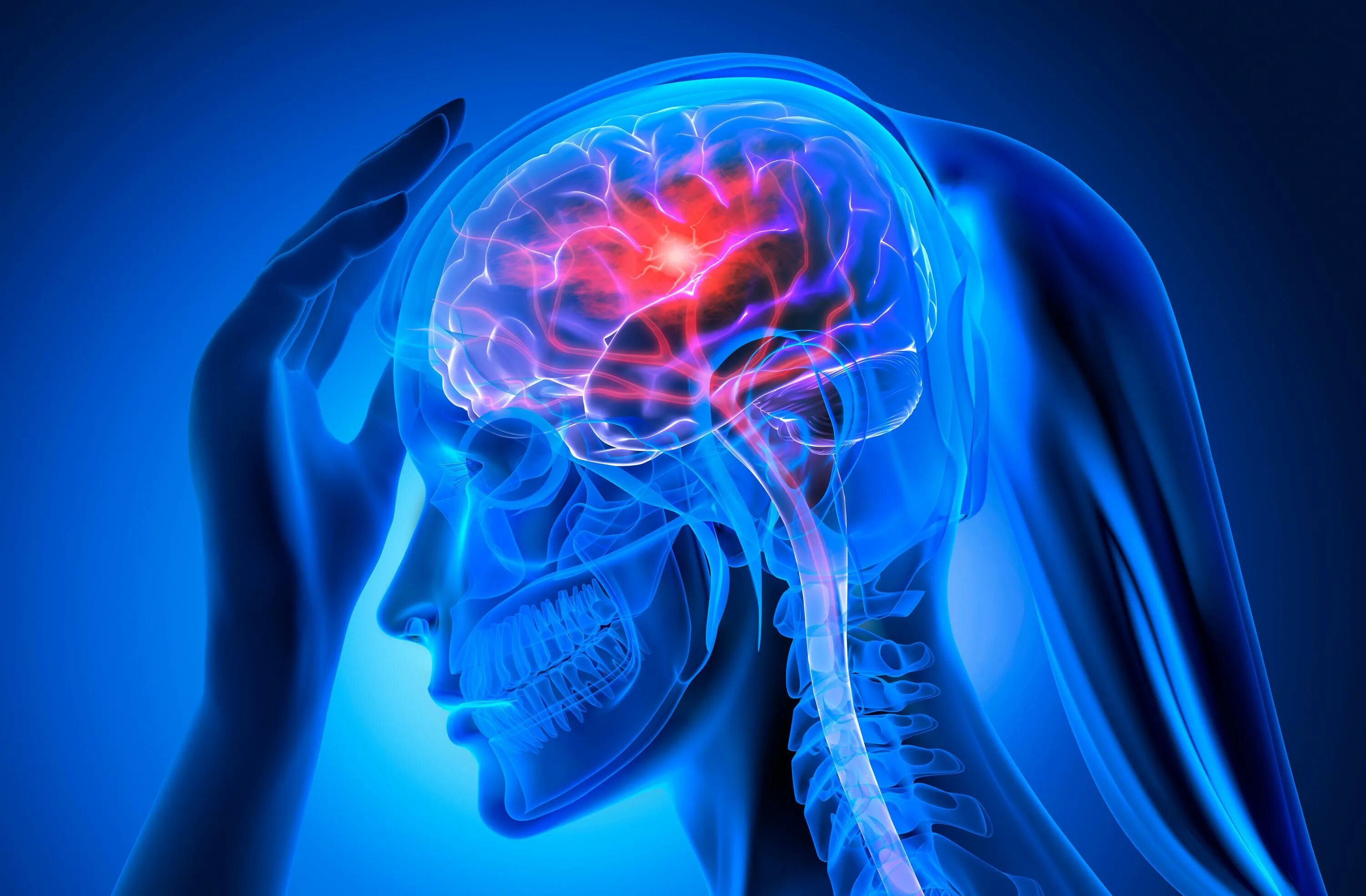 Венозный инсульт. Brain stroke illustration. 3d stroke. Stroke Brain image CT.