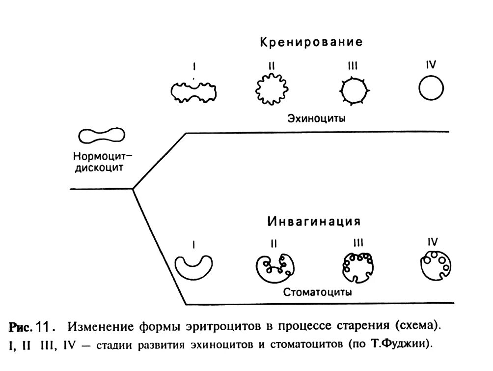 Эхиноциты. Стареющие формы эритроцитов. Старение эритроцитов. Изменение формы эритроцитов. Старение эритроцита этапы.