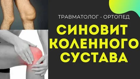 Синовит коленного сустава лечение отзывы