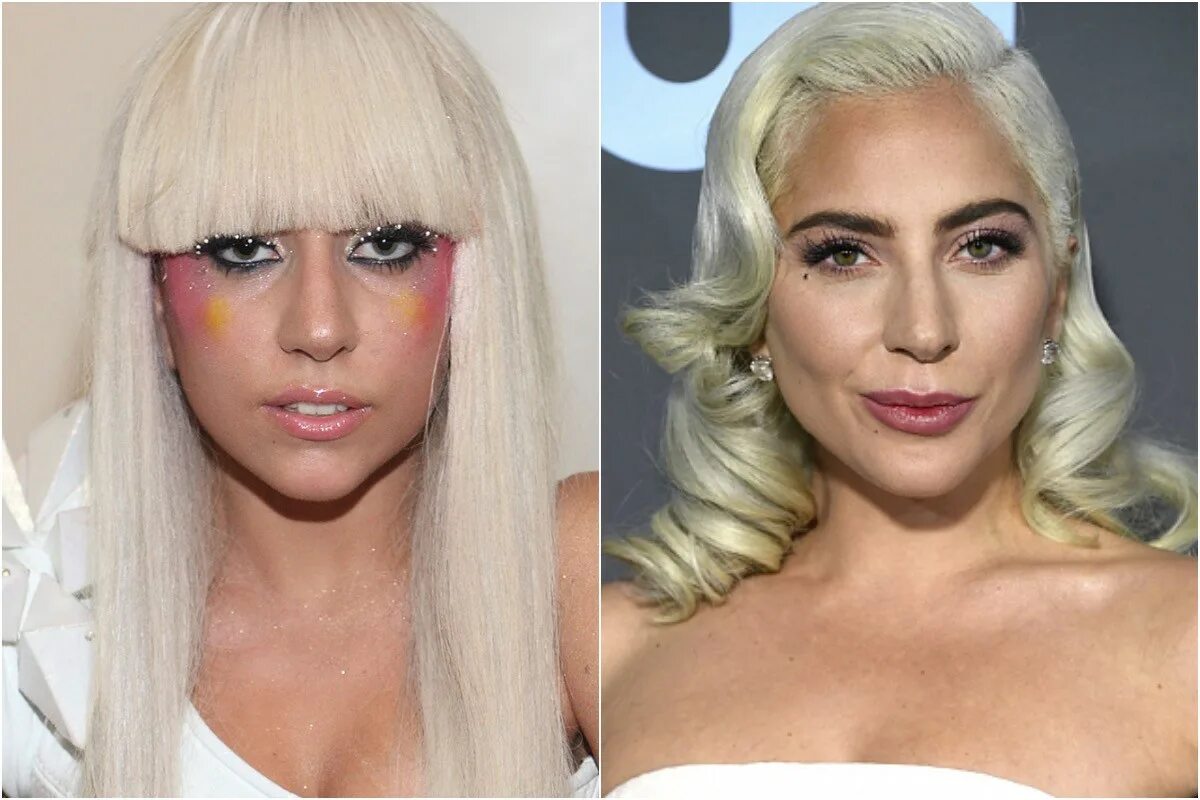 Леди Гага до пластической операции. Леди Гага до пластики. Гага ринопластика. Леди Гага 2021. Почему леди гага