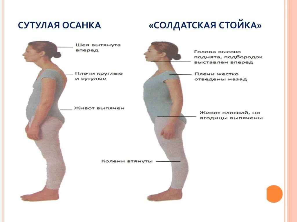 Осанка человека презентация. Солдатская осанка. Сгорбленная осанка. Упражнения против лордоза поясничного отдела. Сутулый слово.