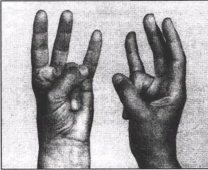 Мудра 20. Мудра зуб дракона. Мудра зуб дракона выполнение. Мудра жизни прана мудра. Ашвини мудра.