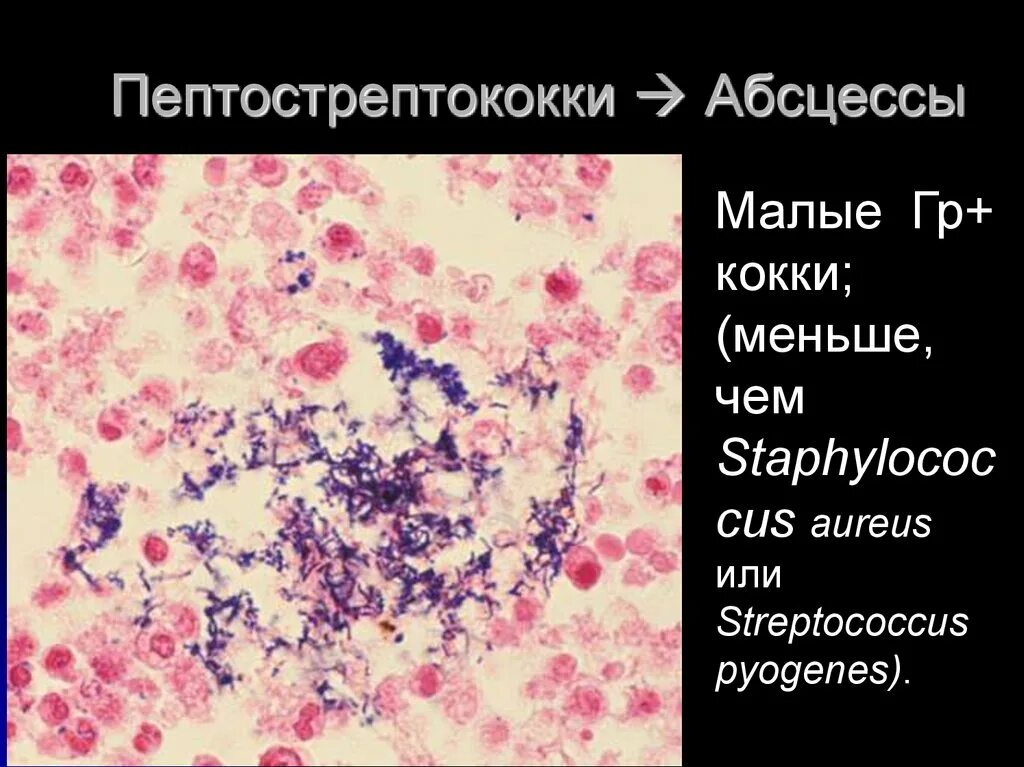 Микрофлора кокки. Пептострептококки заболевания. Пептострептококки ротовой полости морфология. Грам + кокки.