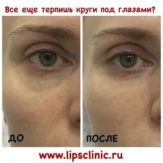 Сферогель под глаза отзывы