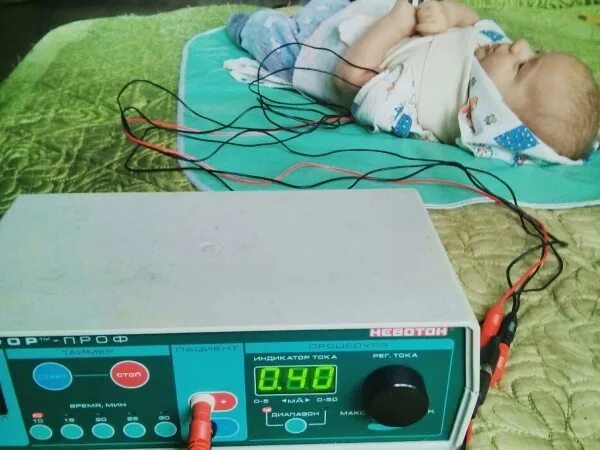 Сколько делать электрофорез. Электрофорез физиотерапия для грудничков. Физиолечение электрофорез для детей. Физиопроцедуры электрофорез.