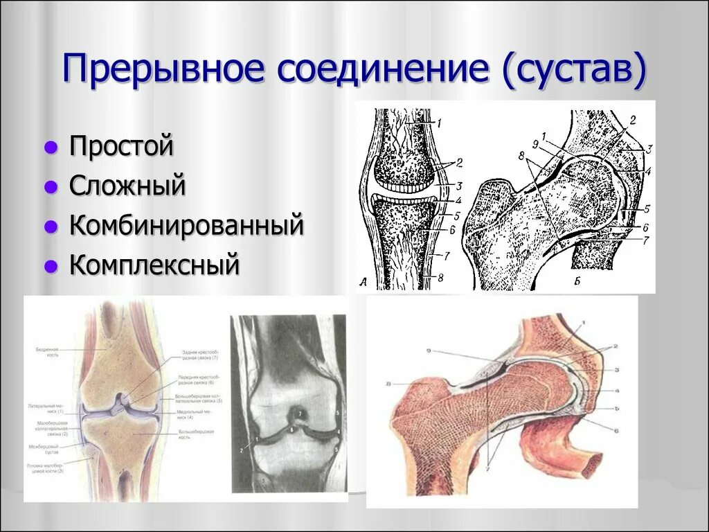 Сустав 2 соединение костей. Прерывные соединения костей. Прерывные соединения суставы. Прерввное соединение кости. Соединение костей строение сустава.