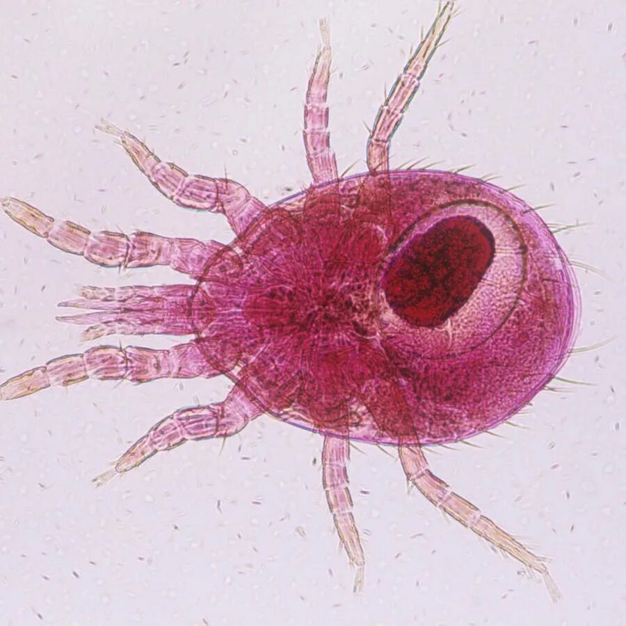 Чесоточный клещ Sarcoptes scabiei. Чесоточный зудень препарат микроскоп.
