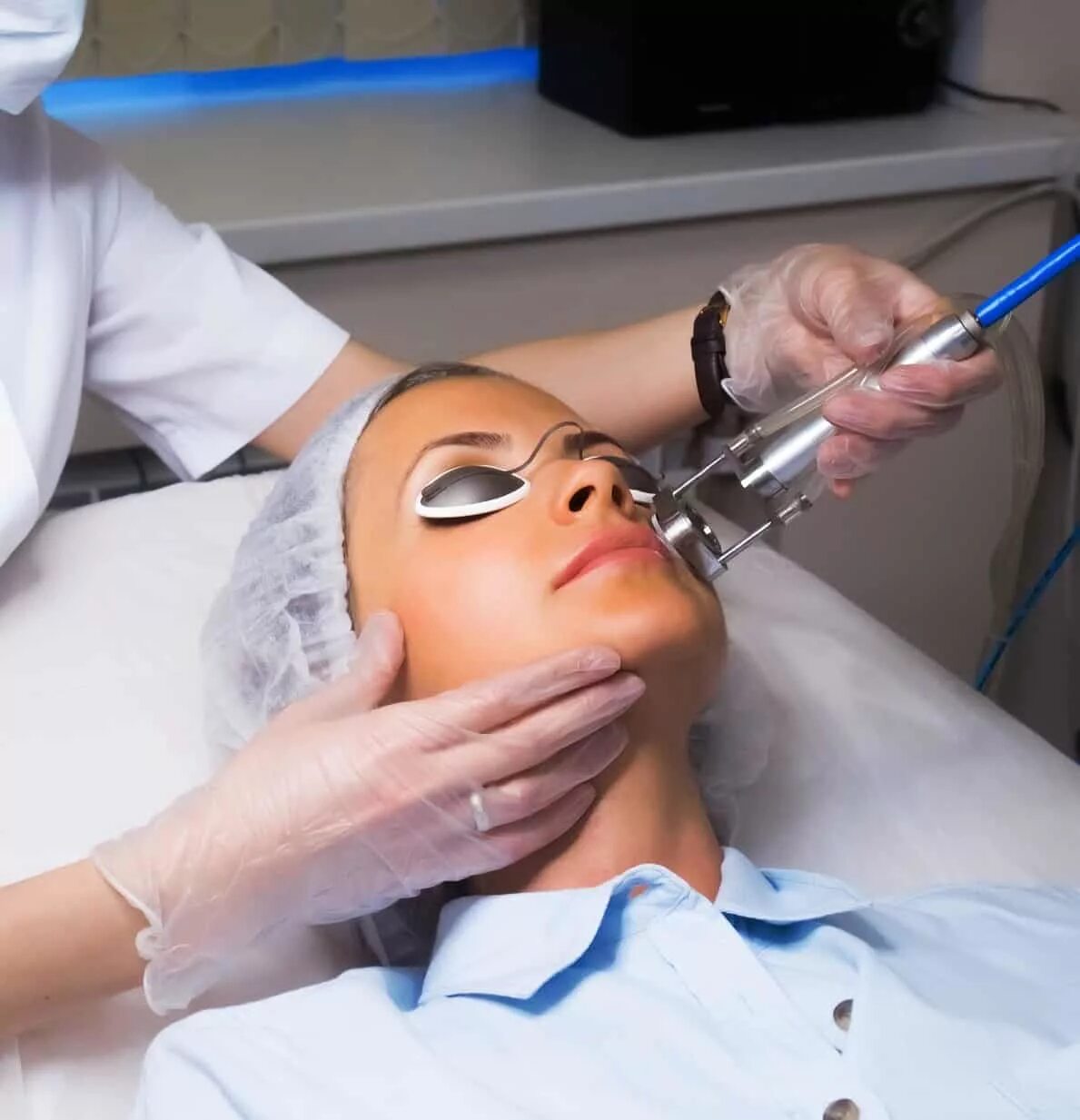 косметология. лазерная терапия в косметологии. лазерная терапия сосудистых звездочек. неодимовый лазер звездочка. фракционный неодимовый лазер.