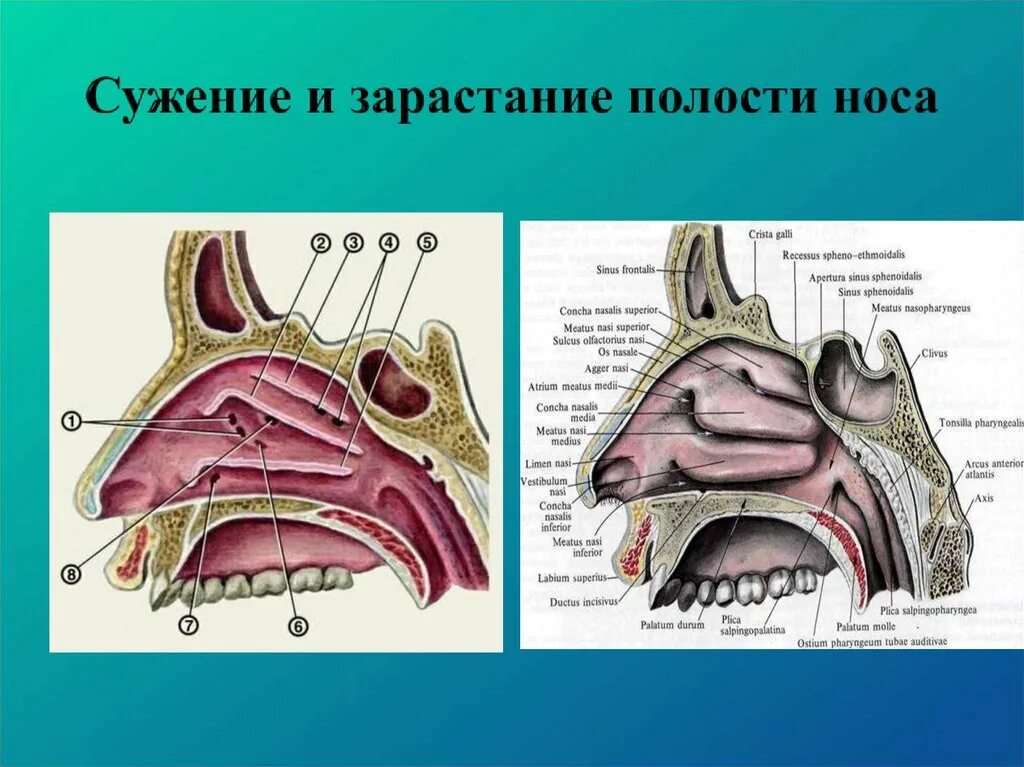 Носовая полость строение кости. Носовая полость строение хоаны. Носовые полости анатомия костей. Хоаны носа анатомия. Полость носа особенности строения