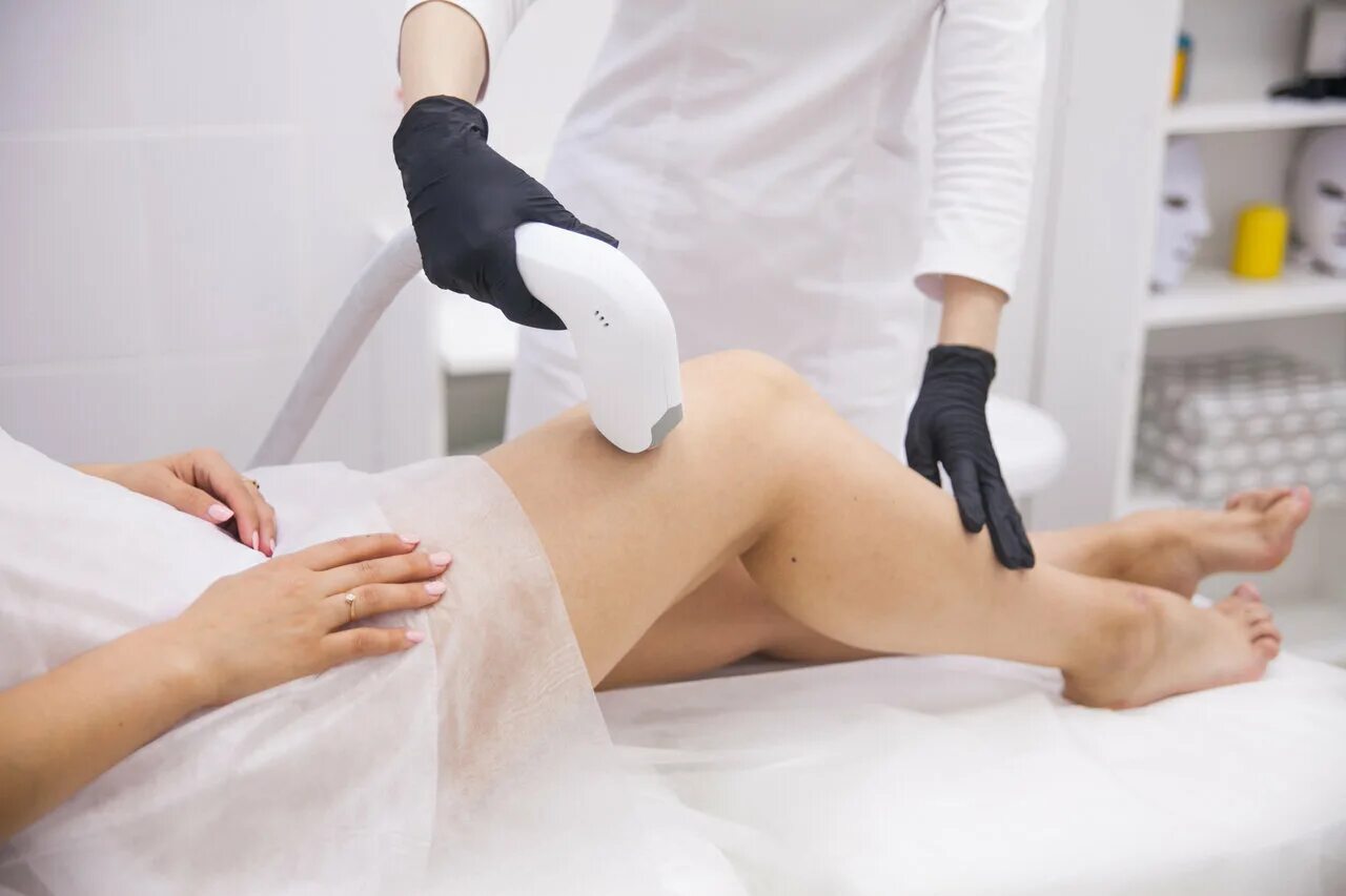 элос эпиляция. лазерный черный эпиляция. диодная лазерная эпиляция. лазерный черный эпиляция. аппарат лазерной эпиляции alma laser soprano ice.