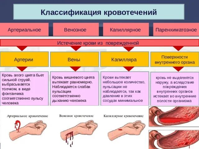 Ярко красный цвет крови является признаком. Классификация кровотечений по анатомическому признаку. Капиллярное кровотечение , венозное таблица. Классификация кровотечений смешанное кровотечение. Классификация кровотечений по виду поврежденного сосуда.