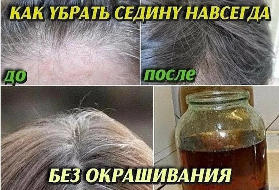 Волос избавление от седины. Можно ли избавиться от седины. Как убрать седину навсегда без окрашивания. Дарсонваль для волос от седины. Окрашивание картофельной кожурой.