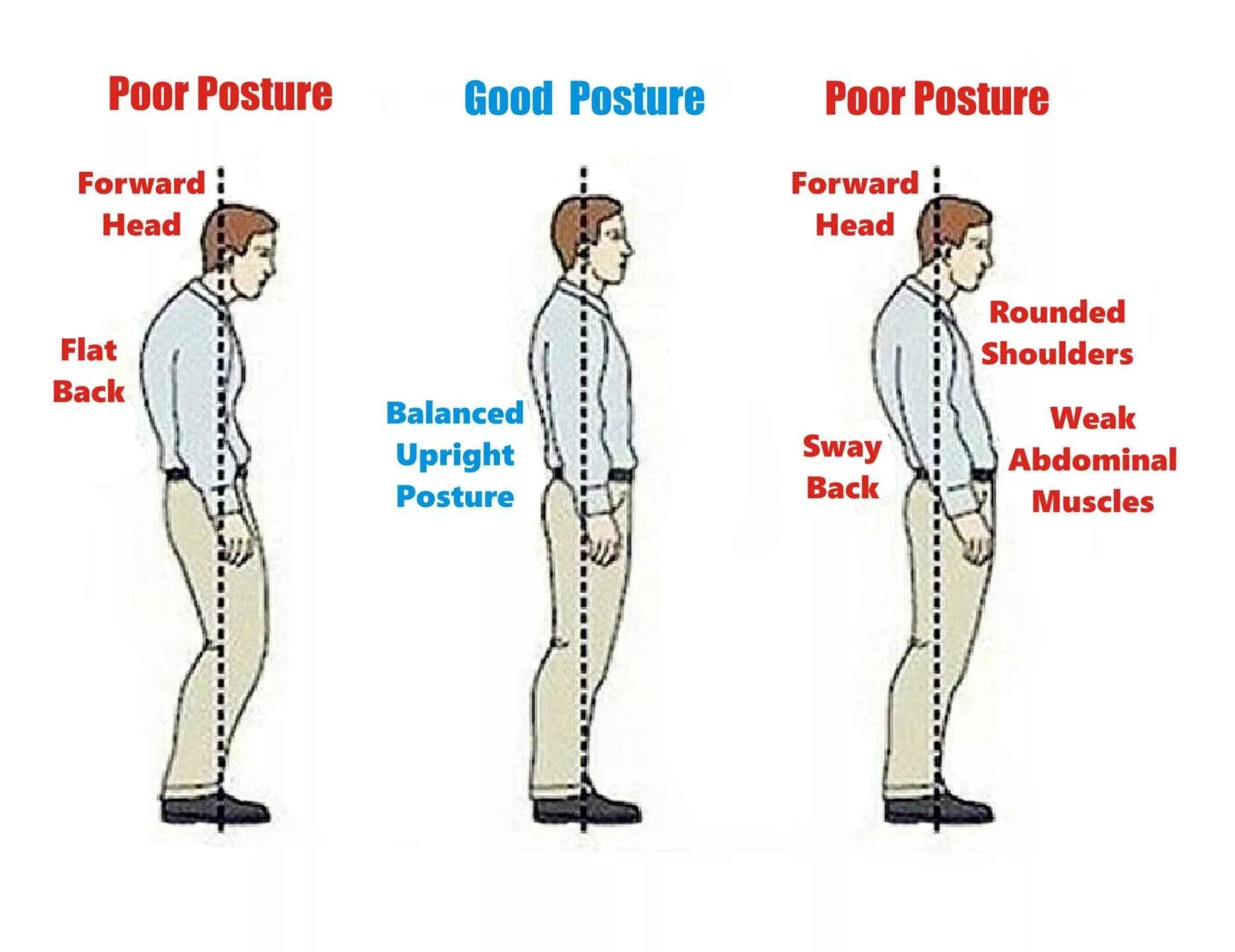 Disney pictures posture in people. Swayback осанка. standing posture. poor posture. types of standing posture.