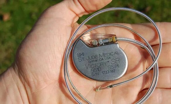 Если стоит кардиостимулятор можно. Кардиостимулятор Siemens Elema. Имплантация сердца кардиостимулятор. Двухкамерный кардиовертер-дефибриллятор. Батарейка для кардиостимулятора.