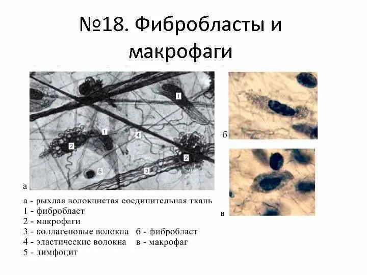 Макрофаги препарат. Фибробласты и макрофаги рыхлая волокнистая соединительная ткань. Фибробласты и макрофаги гистология. Препарат рыхлой волокнистой ткани Макрофаг. Фибробласты фиброциты фибробласты.