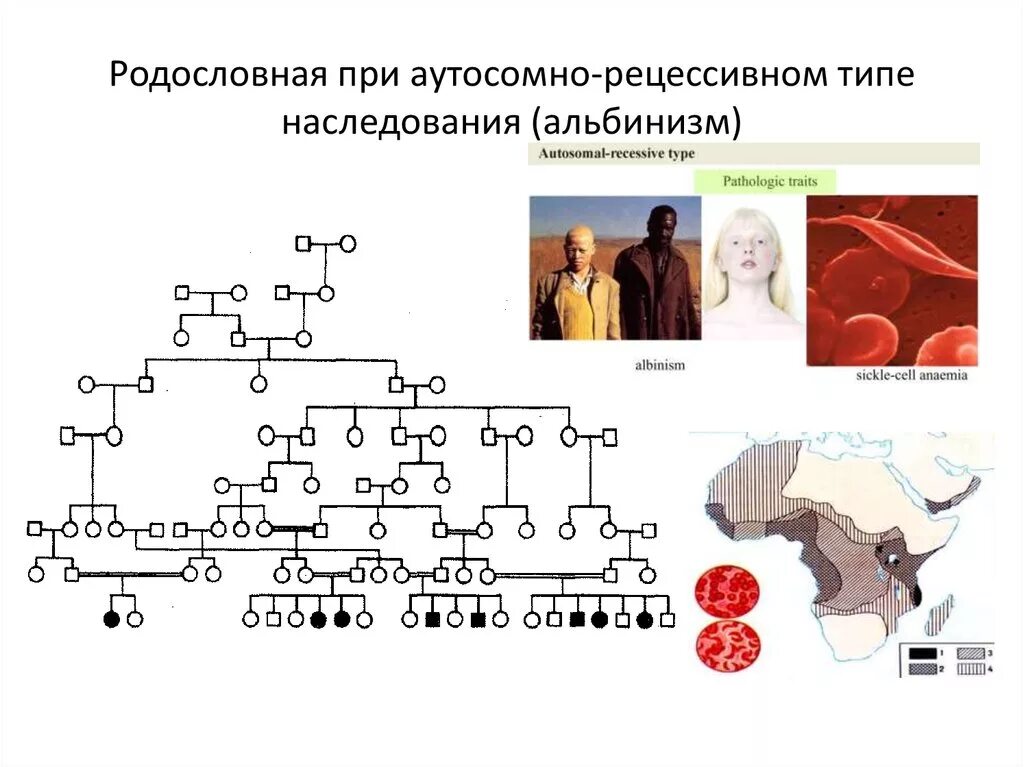 Аутосомно-рецессивный Тип родословная. Аутосомно-рецессивный Тип наследования альбинизма. Альбинизм генетика схема. Альбинизм Тип наследования. Аутосомно рецессивные наследственные заболевания